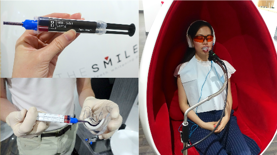 【THE SMILE BAR初體驗】無痛牙齒美白不是夢？