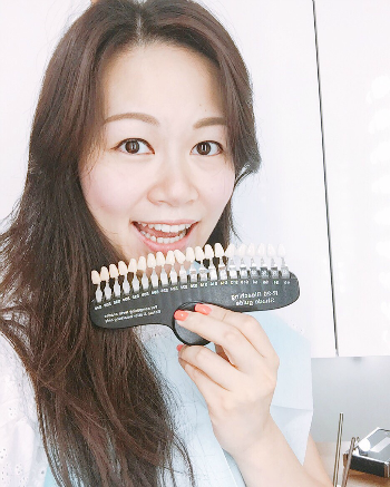 【THE SMILE BAR初體驗】無痛牙齒美白不是夢？